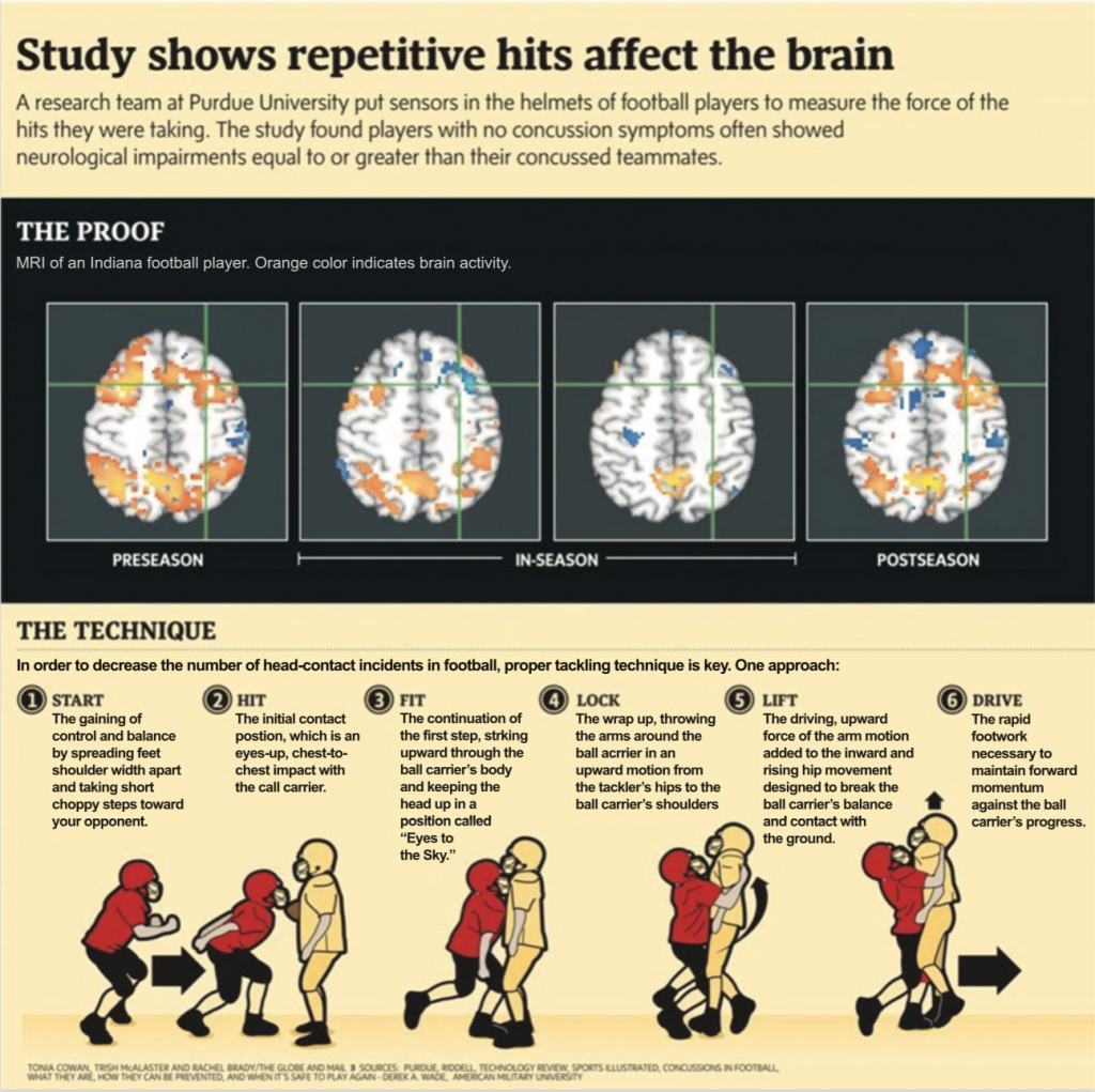 NFL executive's comments on CTE quickly attract notice - Los